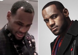 Lebron James close up Before and after Hair plugs