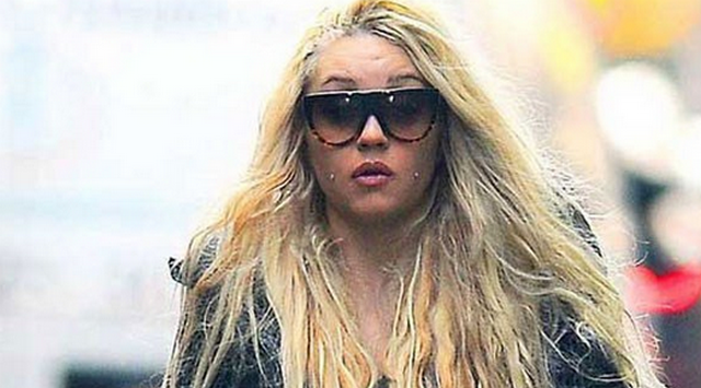 Amanda Bynes: There’s A Surgery For That!