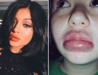 Kylie Jenner Finally Responds To The Ridiculous ‘Lip Challenge’ Hitting The Internet