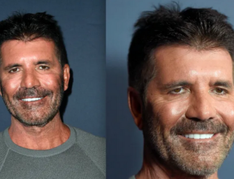 Simon Cowell Says He is Filler Free.  Admits that He Over did it with Botox injections.