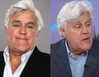 Jay Leno Reveals His “Brand New Face” After Suffering Major Burns In Freak Accident